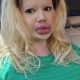 Жінка з найбільшими губами у світі хоче переплюнути українку (фото)